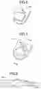 Fig. 06 - Vehicle leaf spring shackle