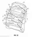 Fig. 20 - Flexible seatback system
