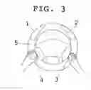 Fig. 04 - Steering wheel cover with inflatable hand-holds