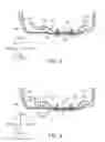 Fig. 09 - Side body structure of vehicle