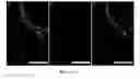 Fig. 02 - METHODS AND COMPOSITIONS PERTAINING TO HUMAN CEREBRAL CAVERNOUS MALFORMATIONS
