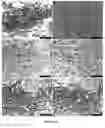 Fig. 03 - METHODS AND COMPOSITIONS PERTAINING TO HUMAN CEREBRAL CAVERNOUS MALFORMATIONS