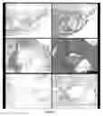 Fig. 20 - METHODS AND COMPOSITIONS PERTAINING TO HUMAN CEREBRAL CAVERNOUS MALFORMATIONS