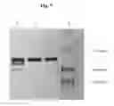 Fig. 08 - Process for the production and purification of the collagenase enzyme from vibrio alginolyticus