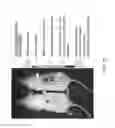 Fig. 17 - GENETICALLY MODIFIED MSC AND THERAPEUTIC METHODS