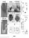 Fig. 02 - TIE2 RECEPTOR ACTIVATION FOR GLAUCOMA