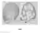 Fig. 09 - TIE2 RECEPTOR ACTIVATION FOR GLAUCOMA