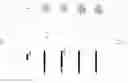 Fig. 07 - Detection of DNA that originates from a specific cell-type and related methods