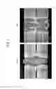 Fig. 02 - Laser welded joint and method of production of same