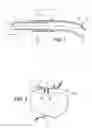 Fig. 02 - Fluid connection system and production method