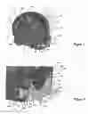 Fig. 02 - Tape measuring device