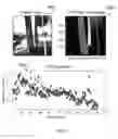 Fig. 09 - System and method for achieving fast and reliable time-to-contact estimation using vision and range sensor data for autonomous navigation