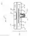 Fig. 09 - Implantable vibratory device using limited components
