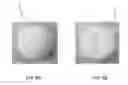 Fig. 05 - COMPOSITION FOR DIETARY SUPPLEMENT