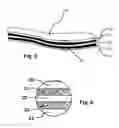 Fig. 06 - Force mitigating athletic shoe