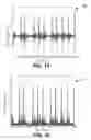 Fig. 14 - Detection and analysis of cardiac waveforms