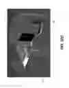 Fig. 41 - Extremity imaging apparatus for cone beam computed tomography