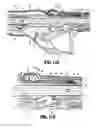 Fig. 09 - Surgical stapling device with firing indicator