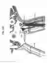 Fig. 35 - Surgical clip applier methods