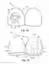 Fig. 02 - Dental attachment placement structure