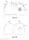 Fig. 09 - Dental attachment placement structure