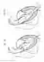 Fig. 03 - Systems of heart valve delivery on a beating heart