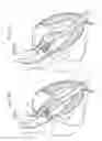Fig. 05 - Systems of heart valve delivery on a beating heart