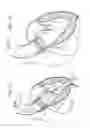 Fig. 06 - Systems of heart valve delivery on a beating heart