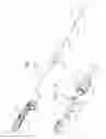 Fig. 10 - Systems of heart valve delivery on a beating heart