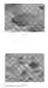 Fig. 02 - Absorbing eluting spacer device
