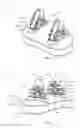 Fig. 02 - ARTHROPLASTY PROSTHESES WITH MULTI-AXIS FIXATION
