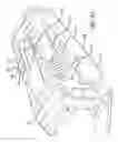 Fig. 30 - Geared cam expandable interbody implant and method of implanting same