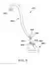 Fig. 08 - Ureteral stent for placement in a kidney and bladder