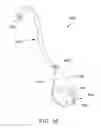 Fig. 09 - Ureteral stent for placement in a kidney and bladder