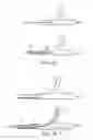 Fig. 08 - Partially crimped stent