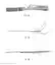 Fig. 11 - Partially crimped stent