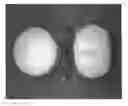 Fig. 01 - TAMPER RESISTANT DOSAGE FORMS