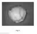 Fig. 09 - TAMPER RESISTANT DOSAGE FORMS