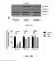 Fig. 06 - METHODS AND COMPOSITIONS COMPRISING AKT INHIBITORS AND/OR PHOSPHOLIPASE D INHIBITORS