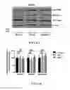 Fig. 08 - METHODS AND COMPOSITIONS COMPRISING AKT INHIBITORS AND/OR PHOSPHOLIPASE D INHIBITORS