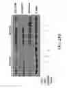 Fig. 41 - METHODS AND COMPOSITIONS COMPRISING AKT INHIBITORS AND/OR PHOSPHOLIPASE D INHIBITORS