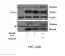 Fig. 44 - METHODS AND COMPOSITIONS COMPRISING AKT INHIBITORS AND/OR PHOSPHOLIPASE D INHIBITORS