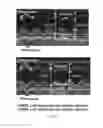 Fig. 59 - COMPOSITIONS AND METHODS FOR TREATING ACUTE RADIATION SYNDROME