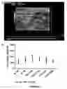 Fig. 09 - HEART FAILURE TREATMENT