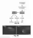 Fig. 09 - Method of treating a bladder cancer using a chimeric EGF-targeted bacterial toxin