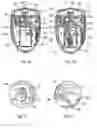 Fig. 02 - Device for distribution of fluid product triggered by inhalation