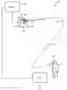 Fig. 01 - Detecting combustion of a nasal cannula