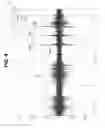 Fig. 06 - Abnormal vehicle dynamics detection