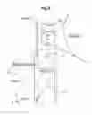 Fig. 07 - Aircraft provided with a buoyancy system, and a buoyancy method