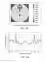 Fig. 10 - Systems and methods for fluid treatment with homogeneous distribution of ultraviolet light